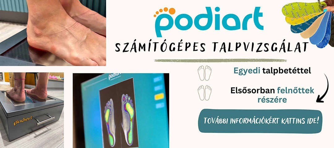 Podiart egyedi számítógépest talpbetét
