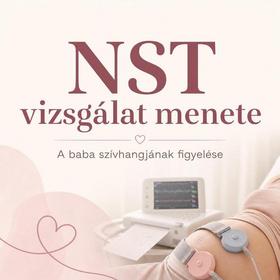 NST vizsgálat menete